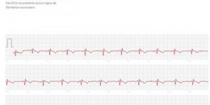 «Le Figaro» a testé l’électrocardiogramme de l’Apple Watch