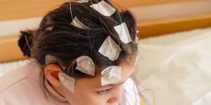 Les crises d’absence, une forme méconnue d’épilepsie qui touche les enfants