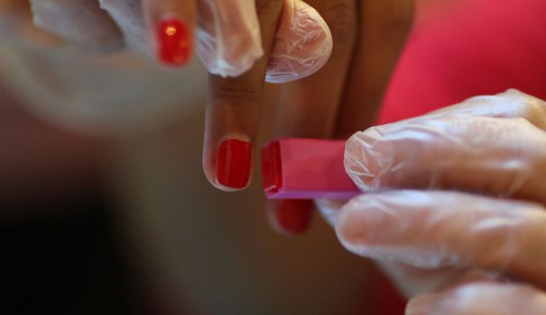 Contre le sida, des chercheurs vont tester un médicament anticancéreux