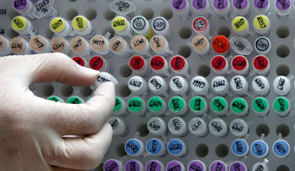 Bioéthique: faut-il s'inquiéter des modifications génétiques sur les embryons?