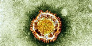 L'Australie parvient à répliquer un nouveau coronavirus en dehors de la Chine