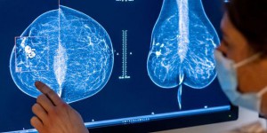 Cancer : comment les scientifiques espèrent nous éviter de tomber malade