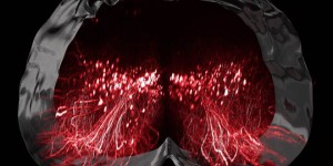 Des chercheurs identifient le neurone qui permet de remarcher