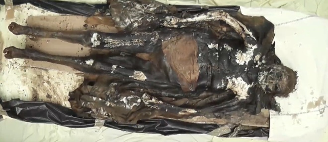 Fabuleuse découverte d'une momie de noble dame du XVIIe siècle à Rennes