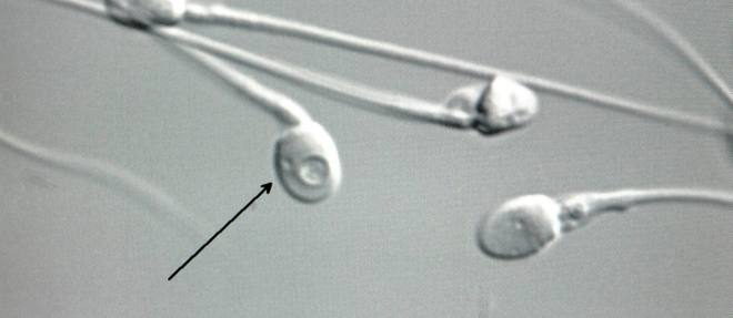 Des spermatozoïdes humains in vitro pour lutter contre l'infertilité