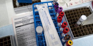 Traitement anti-Covid : les anticorps monoclonaux arrivent en France