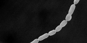Thiomargarita magnifica, un alien dans le petit monde des bactéries