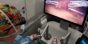 Chirurgie robotique : une première européenne au CHU de Rennes