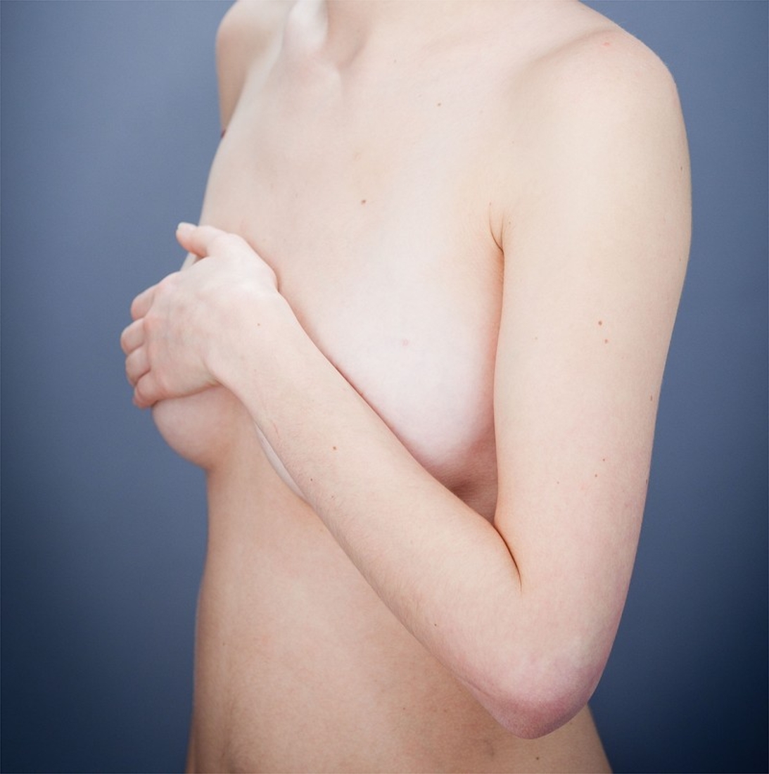 La Belgique compte le taux de cancers du sein le plus élevé au monde