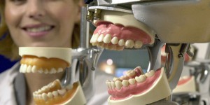 Perdre ses dents : les facteurs qui accélèrent la chute 