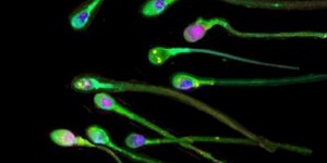 Des spermatozoïdes in vitro qui pourraient révolutionner l’infertilité masculine 