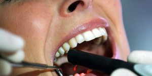 Plus d’un adulte sur 2 en Wallonie et à Bruxelles n’a pas été chez le dentiste en 2016 