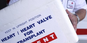 Internet pour faciliter le don d’organes 