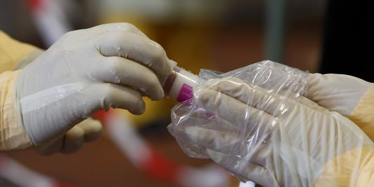 Ebola : un test de diagnostic en 15 minutes mis au point en France