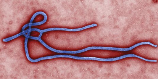 « On s'attend à une évolution significative du virus Ebola »