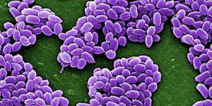 Dix-huit laboratoires américains pourraient avoir reçu de l’anthrax par erreur