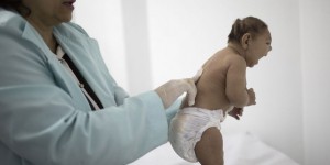 Brésil : 1 271 cas de microcéphalie confirmés, dont 57 mortels