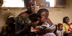Malnutrition : un tiers des pays pauvres touchés à la fois par la sous-alimentation et le surpoids