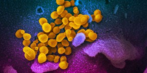 Coronavirus : « Une éradication des maladies infectieuses est tout simplement irréaliste »