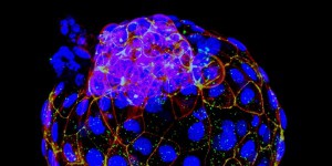 Des modèles d’embryons humains produits à partir de cellules souches