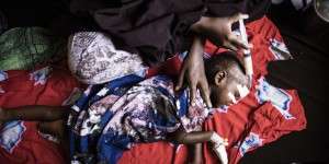 Dans un hôpital de Mogadiscio, l’afflux des enfants victimes de la sécheresse
