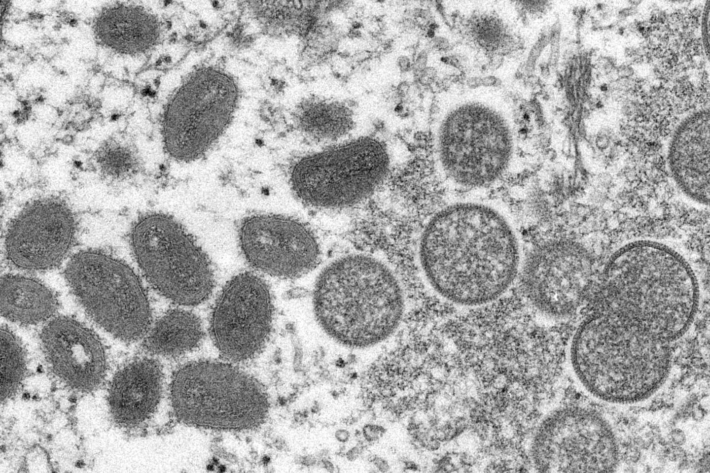 L’OMS va évaluer si la variole du singe représente une « urgence de santé publique internationale »