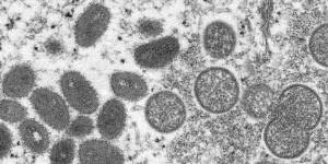 Ce que l’on sait du virus « Langya » repéré en Chine