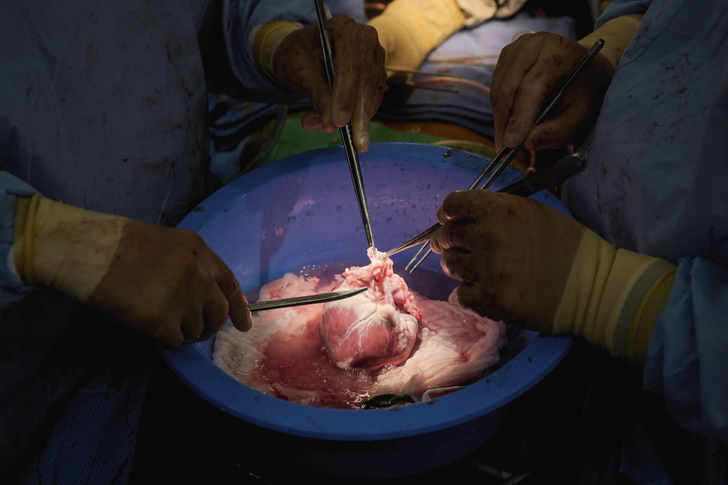 Médecine : des fonctions cellulaires restaurées chez des cochons, une heure après la mort