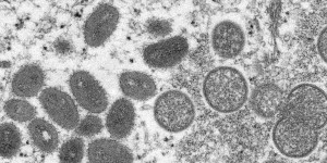 Mpox : la RDC va homologuer en urgence deux vaccins et un traitement pour endiguer l’épidémie