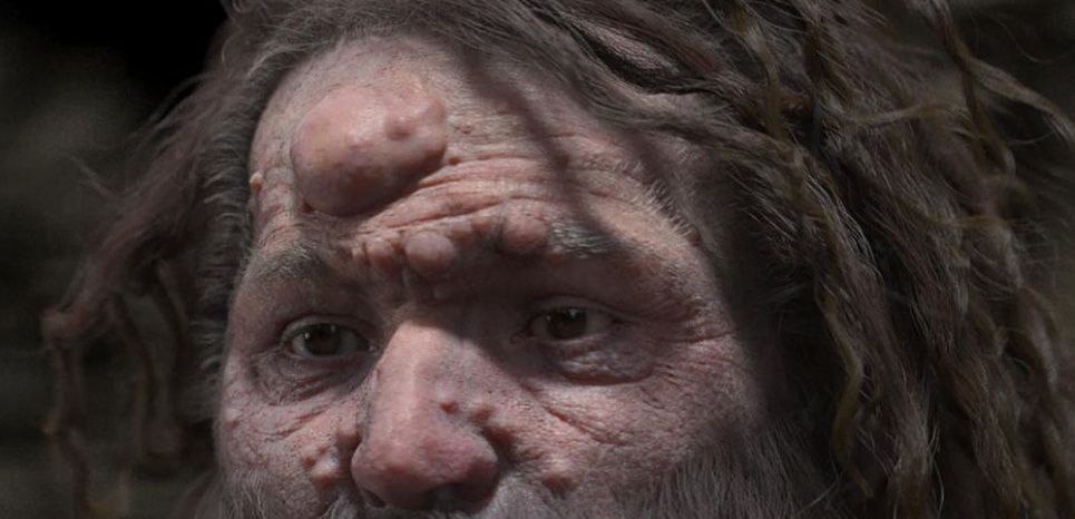 L'homme de Cro-Magnon avait le visage couvert de nodules